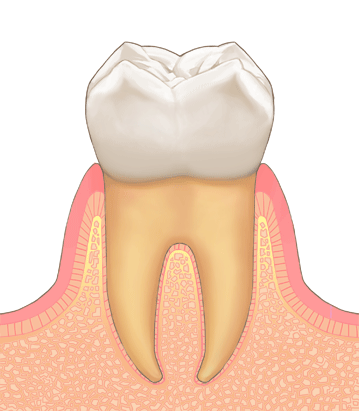 歯茎の健康な状態